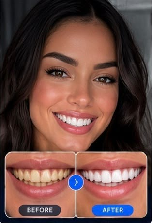 Visora LED Teeth Whitening Kit